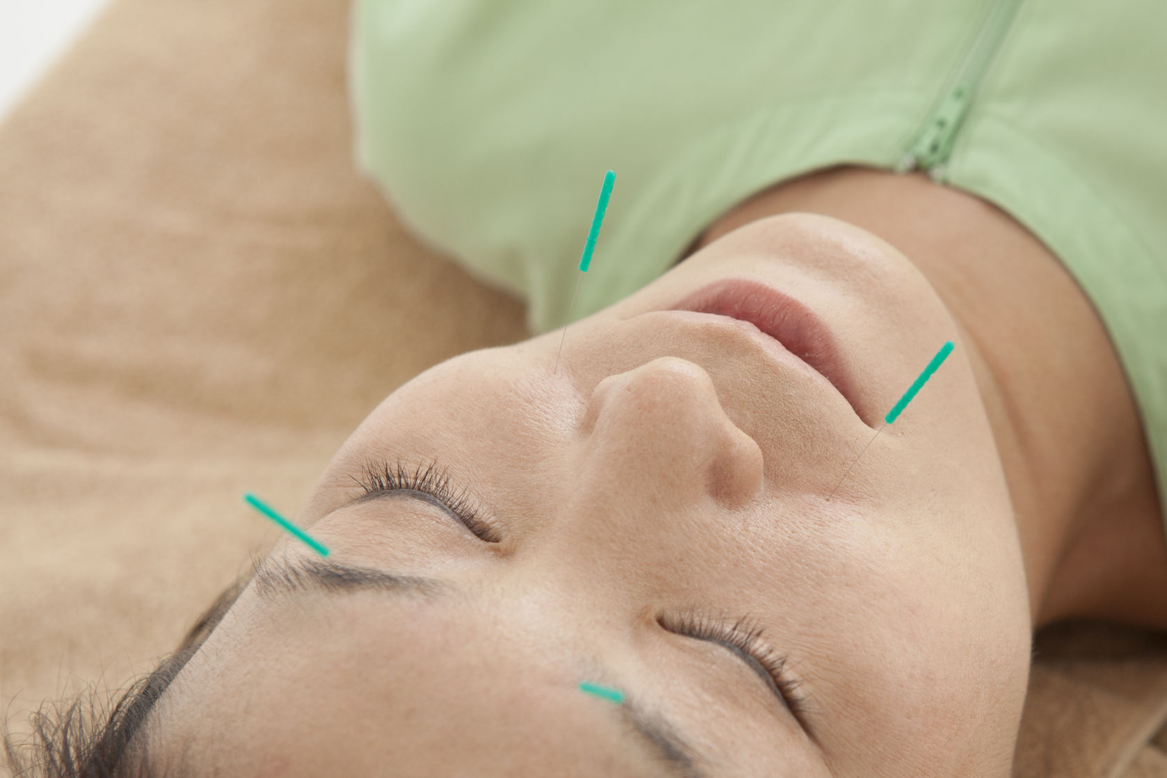 acupuncture is better than drugs for irritable bowel syndrome (IBS)