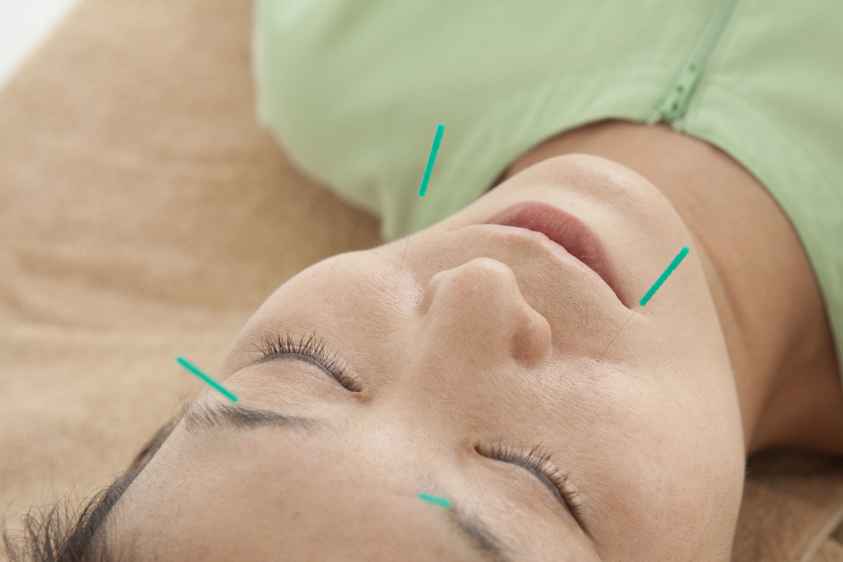 image 123RF.com acupuncture reduces wrinkles