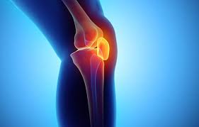 A Potent Herb for Osteoarthritis