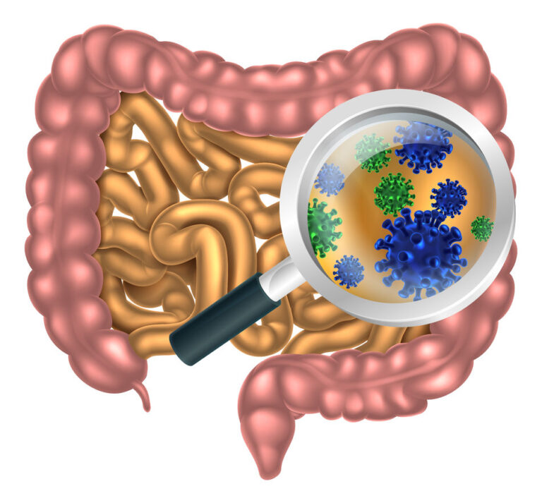 diet affects intestinal microbiome