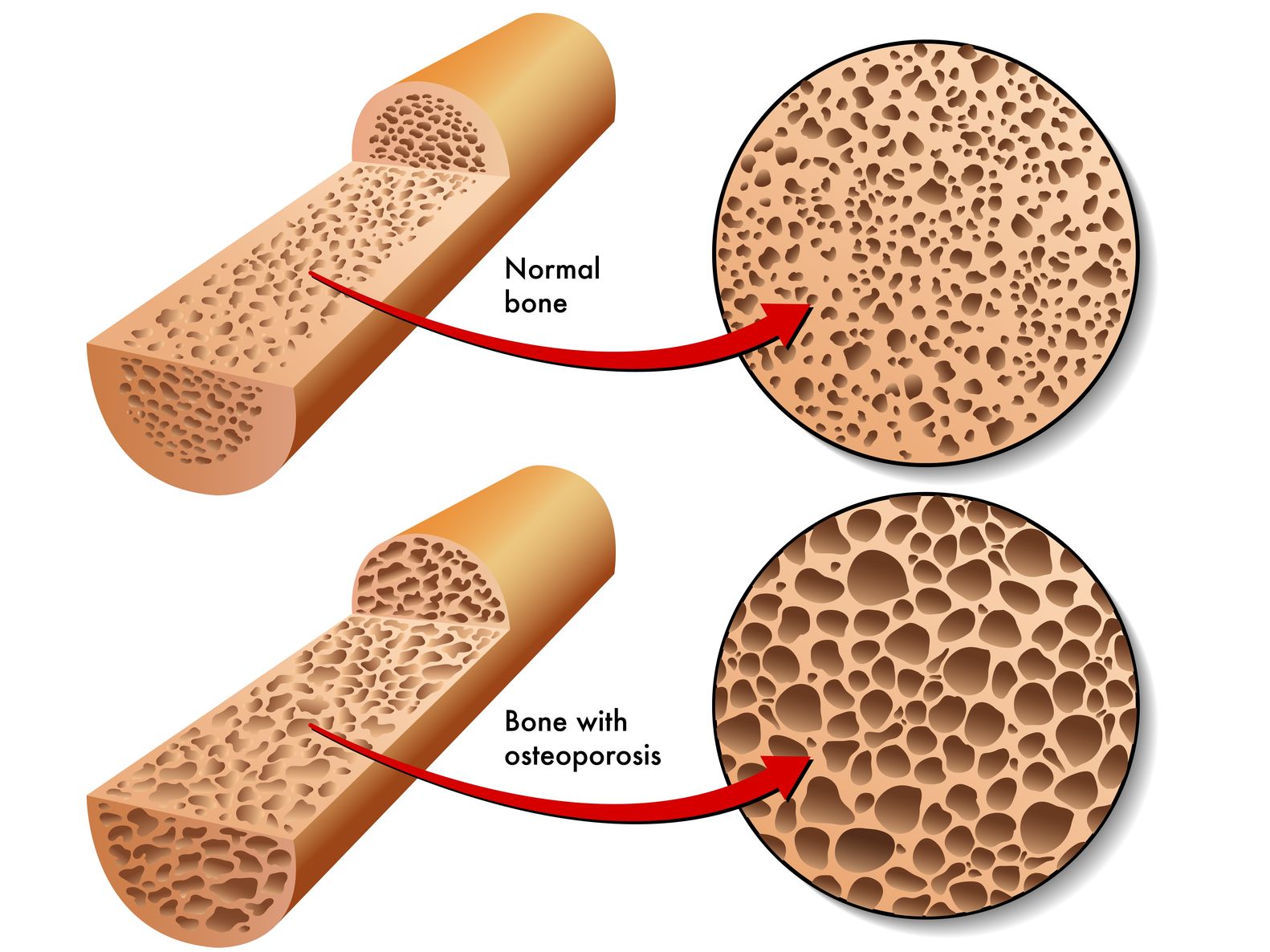 Vitamin E for Your Bones?